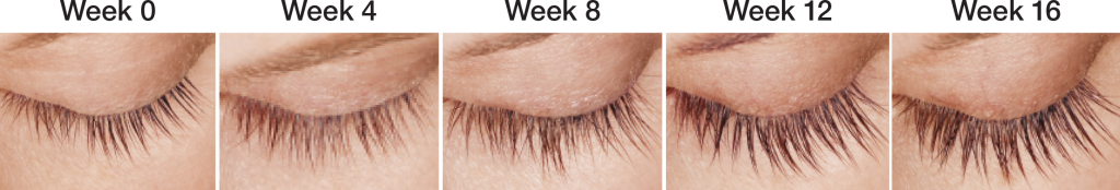 Latisse results after 16 weeks | Bella Derma Laser & Med Spa | Eagleville, PA