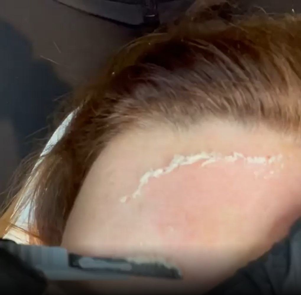 Bella Derma Laser and Med Spa Dermaplaning