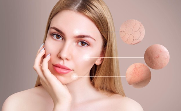 Bella Derma Laser & Med Spa Eagleville PA Microneedling