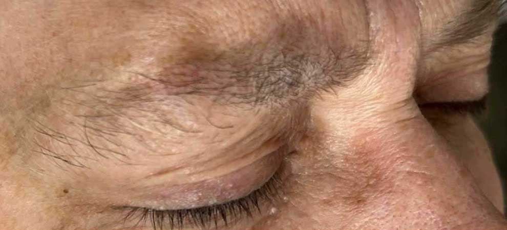 Bella Derma Laser & Med Spa Eagleville PA Microblading
