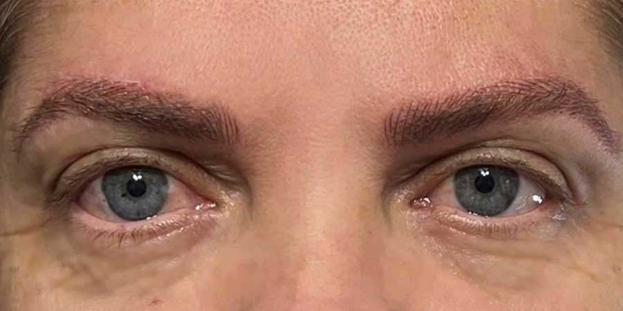 Bella Derma Laser & Med Spa Eagleville PA Microblading