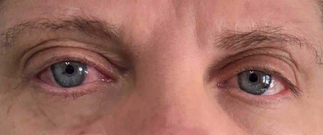 Bella Derma Laser & Med Spa Eagleville PA Microblading