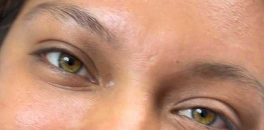 Bella Derma Laser & Med Spa Eagleville PA Microblading